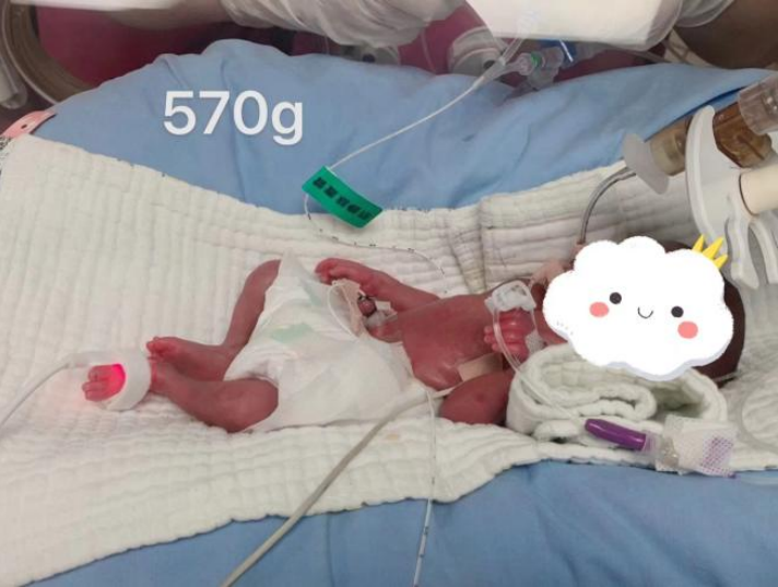 24周，570克！宝安妇幼新生儿科103