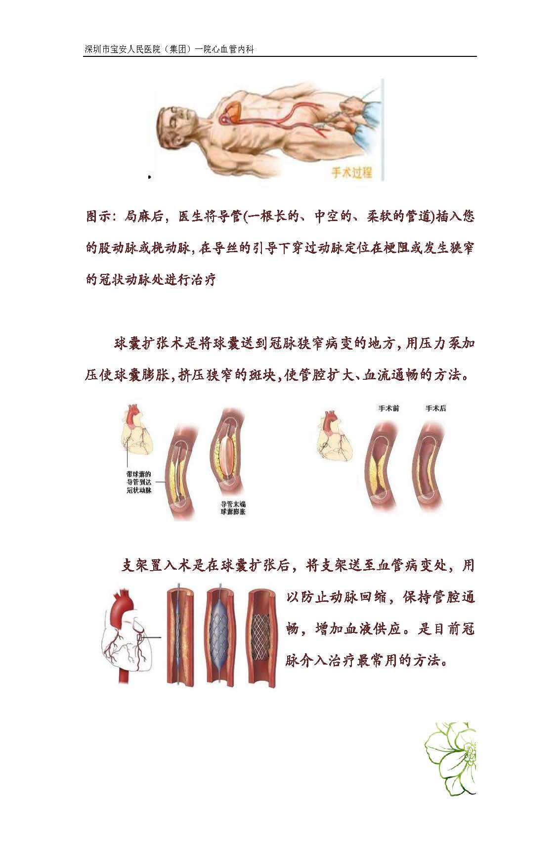 14 成功戒烟小妙招.docx_页面_02