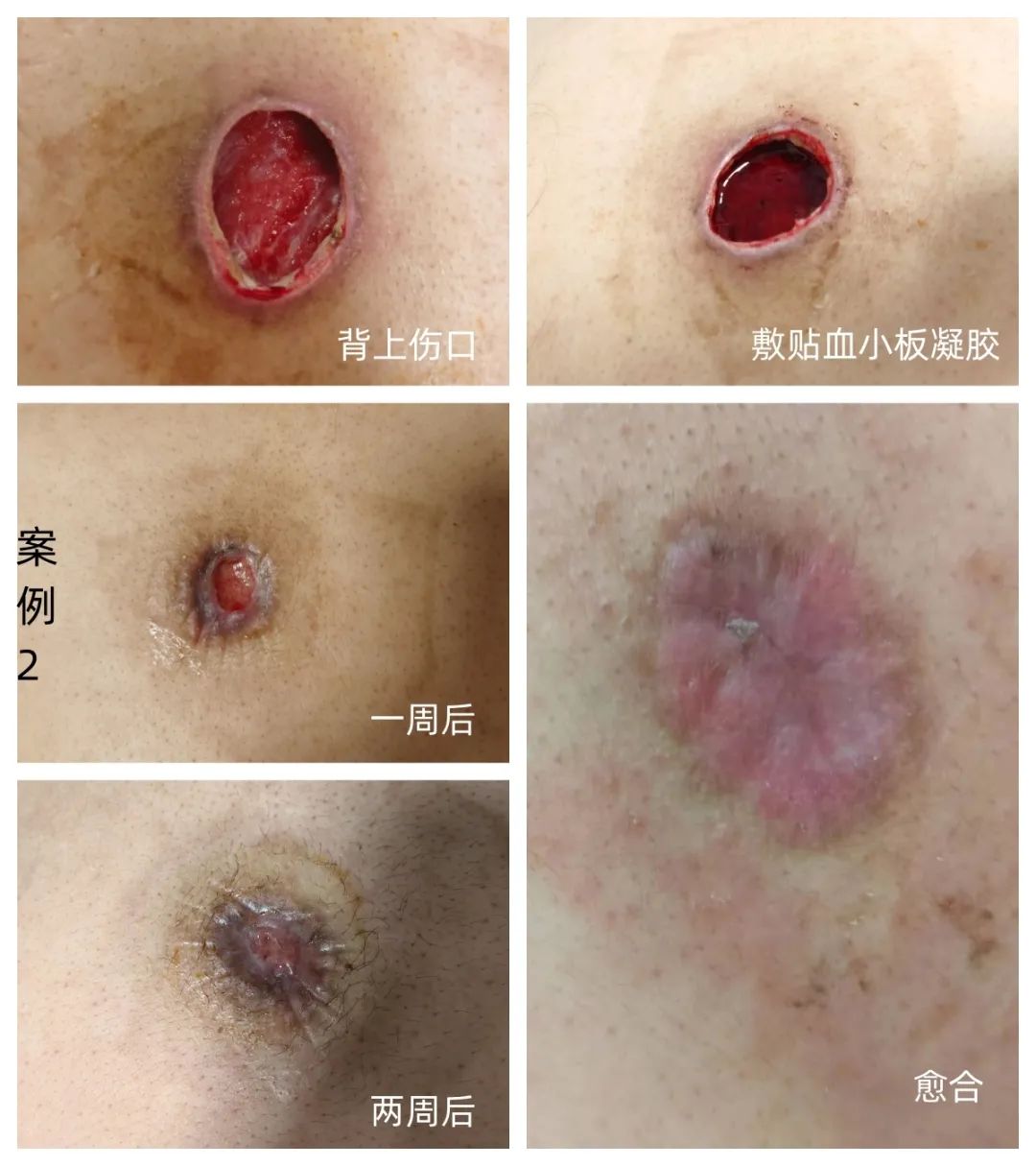 刺激性画面2.jpeg