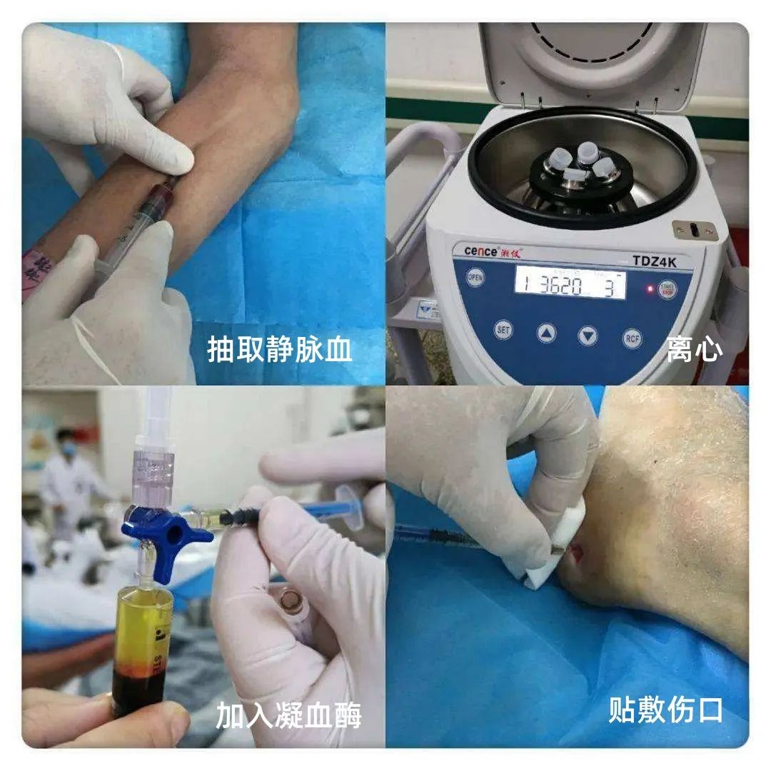 治疗方法1.jpeg