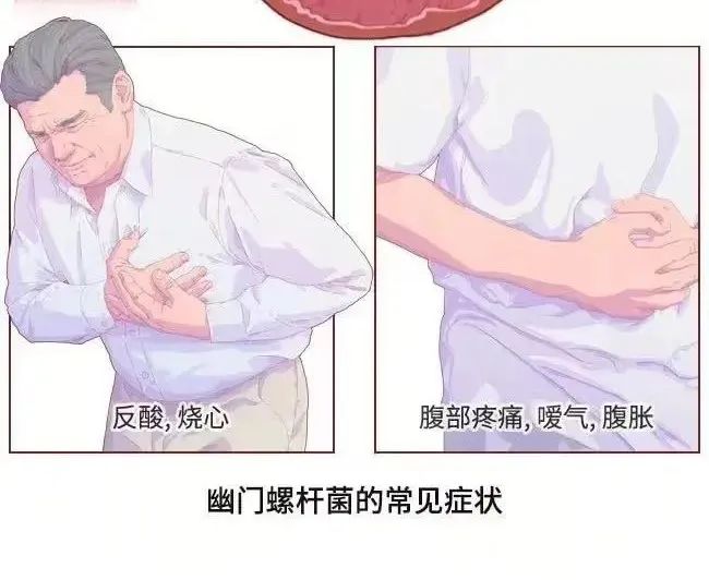 感染幽门螺杆菌有什么症状.jpeg