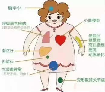 脂肪肝脑卒中.jpg