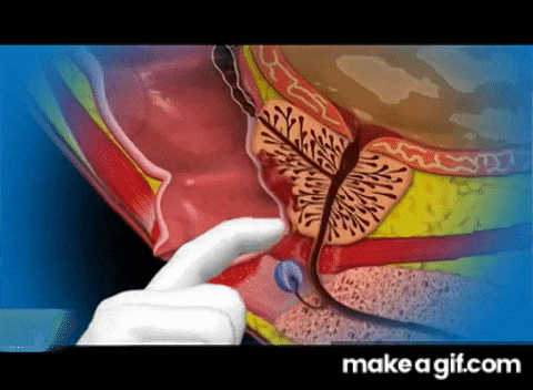 前列腺按摩.gif