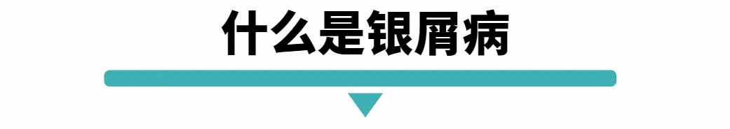 什么是银屑病.jpg