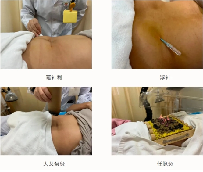 毫针针刺、颊针、浮针、艾灸治疗.png