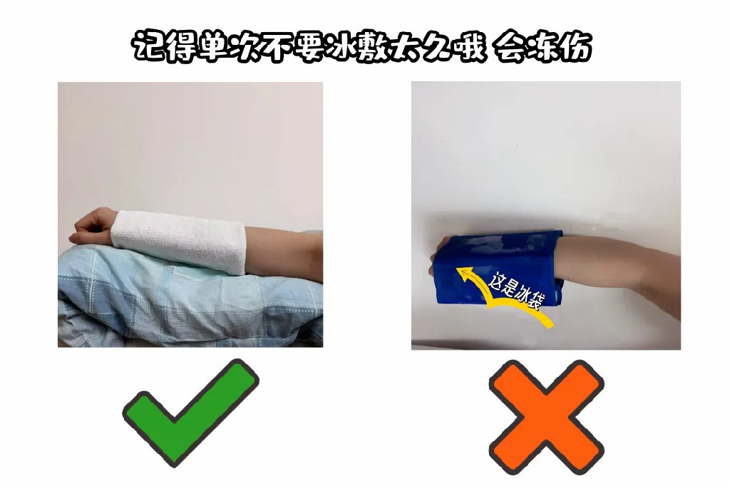 冰敷效果.jpg