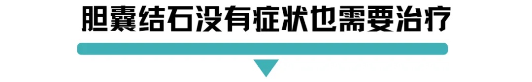 胆囊结石没有症状也需要治疗.jpg