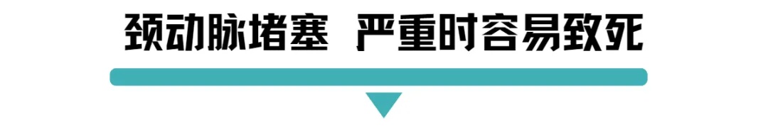 颈动脉堵塞严重时容易致死.jpg