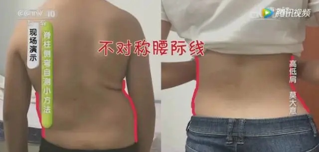 观察腰际线是否对称.jpg