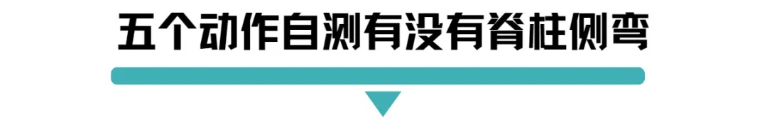 五个动作自测有没有脊柱侧弯.jpg