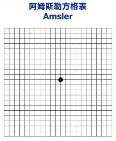 阿姆斯勒方格表.jpg