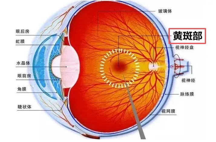 黄斑.jpg
