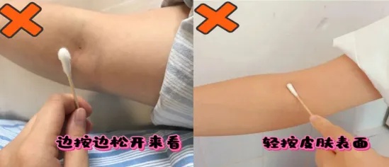 力度均匀地按压针口.jpg