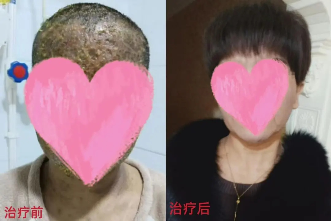 阿布返回新疆维吾尔自治区在且末县人民医院.jpg