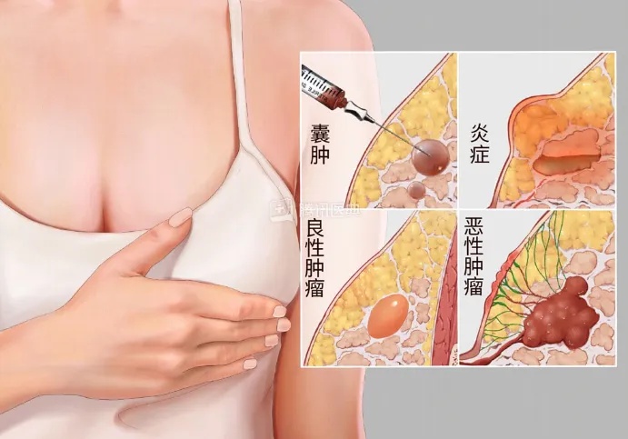 乳腺有多重要.jpg