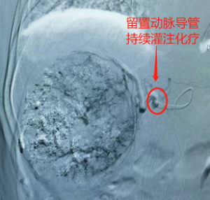 图片13.png