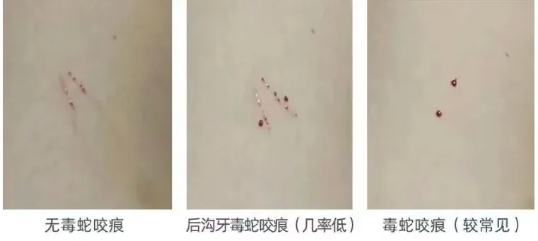 无毒蛇咬了.jpg
