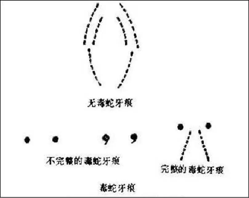 有毒无毒蛇咬了.jpg