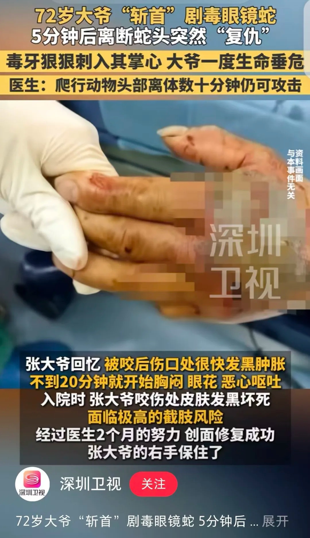 浙江发生了一起断离蛇头“复仇”事件.jpg