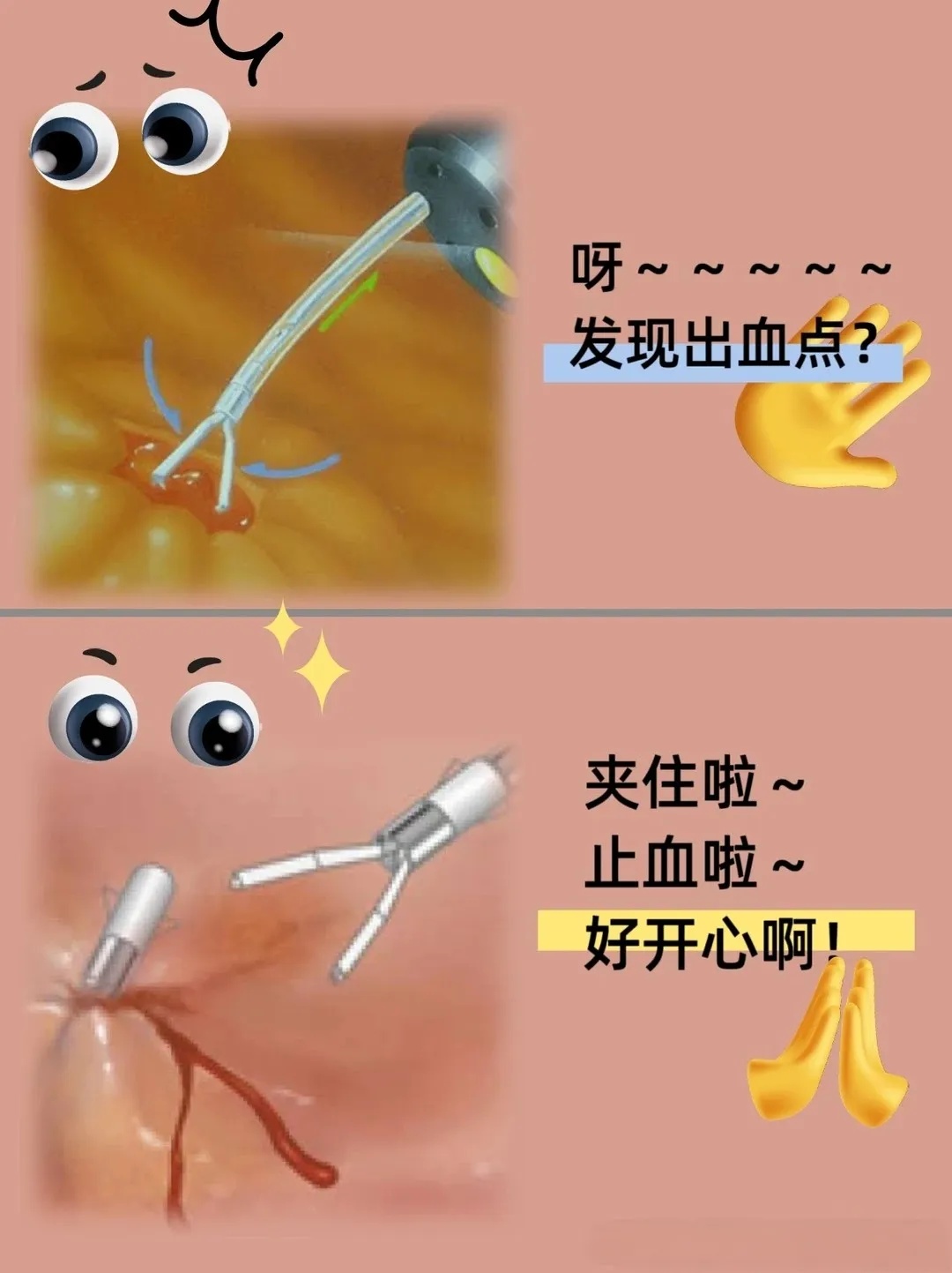 对升结肠区域十余处.jpg