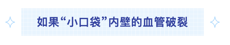 如果小口袋.png