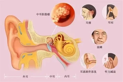 耳痛加剧.jpg