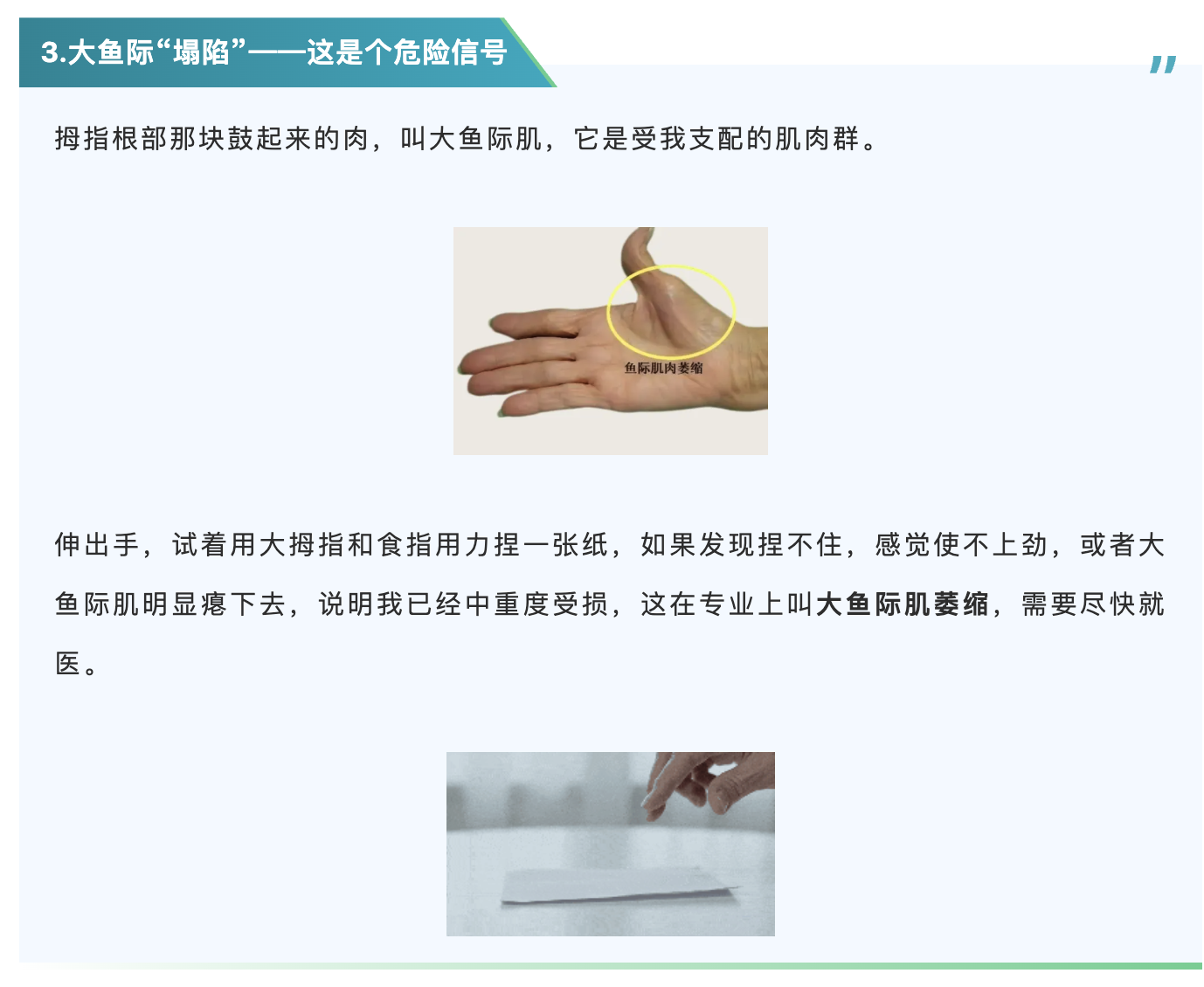 大鱼际.png