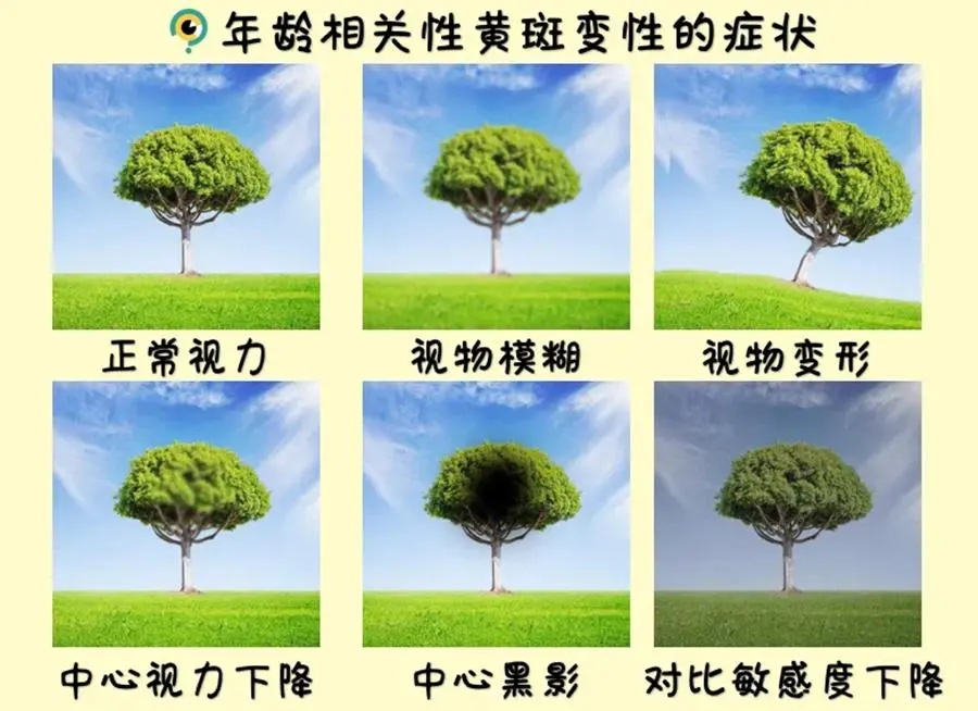 出现“直线变弯”.jpg
